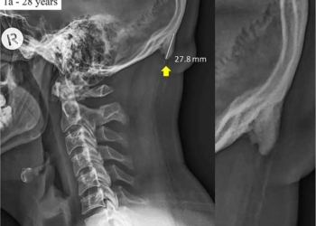 Ci stanno crescendo le corna a causa degli smartphone?