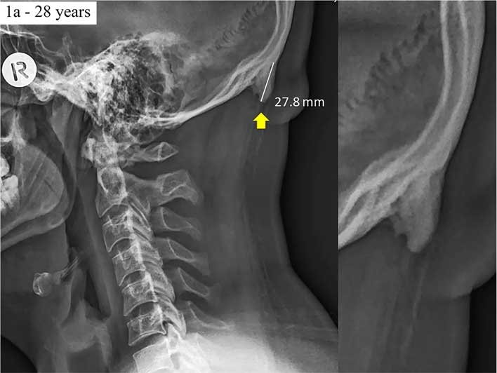 Ci stanno crescendo le corna a causa degli smartphone?
